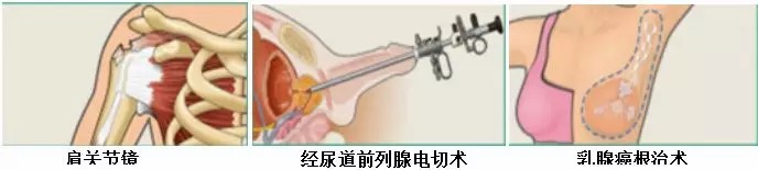 洁净服特性及测试的标准